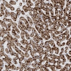 Immunohistochemical staining of human liver shows strong granular positivity in cytoplasm in hepatocytes.