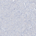 Immunohistochemical staining of human pancreas shows no positivity in exocrine glandular cells as expected.