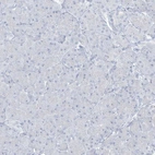 Immunohistochemical staining of human pancreas shows no positivity in exocrine glandular cells as expected.