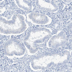 Immunohistochemical staining of human endometrium shows no positivity in glandular cells as expected.