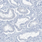Immunohistochemical staining of human endometrium shows no positivity in glandular cells as expected.