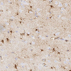 Immunohistochemical staining of human cerebral cortex shows strong cytoplasmic positivity in neurons and glial cells.