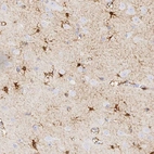 Immunohistochemical staining of human cerebral cortex shows strong cytoplasmic positivity in neurons and glial cells.