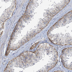 Anti-MRPS18A Antibody