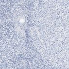 Immunohistochemical staining of human tonsil shows no positivity in non-germinal center cells as expected.