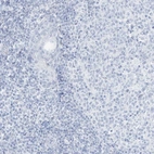 Immunohistochemical staining of human tonsil shows no positivity in non-germinal center cells as expected.
