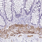 Immunohistochemical staining of human rectum shows strong cytoplasmic granular positivity in smooth muscle cells.