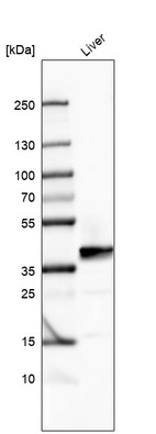 Western blot analysis in human liver tissue.