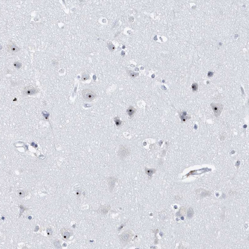 Anti-RPF2 Antibody