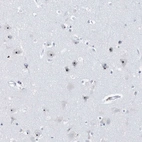 Anti-RPF2 Antibody