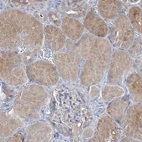 Immunohistochemical staining of human kidney shows moderate granular cytoplasmic positivity in cells in tubules.