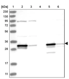 Lane 1: Marker [kDa] 230, 130, 95, 72, 56, 36, 28, 17, 11_br/_Lane 2: Human cell line RT-4_br/_Lane 3: Human cell line U-251 MG_br/_Lane 4: Human plasma_br/_Lane 5: Human Liver tissue_br/_Lane 6: Human Tonsil tissue