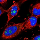 Immunofluorescent staining of human cell line U-251 MG shows positivity in nucleus & nucleoli.