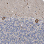 Immunohistochemical staining of human cerebellum shows strong granular cytoplasmic positivity in Purkinje cells.