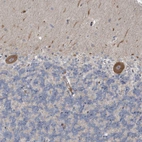 Immunohistochemical staining of human cerebellum shows strong granular cytoplasmic positivity in Purkinje cells.