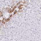 Immunohistochemical staining of human liver shows strong cytoplasmic positivity in subset of cells in hepatocytes.