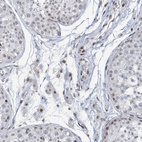 Anti-RFX7 Antibody