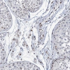 Anti-RFX7 Antibody