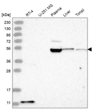 Western blot analysis in human cell line RT-4, human cell line U-251 MG, human plasma, human liver tissue and human tonsil tissue.