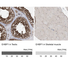 Anti-EHBP1 Antibody