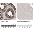 Anti-EHBP1 Antibody