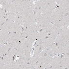 Immunohistochemical staining of human cerebral cortex shows moderate nuclear positivity in glial cells.