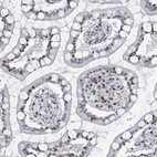 Immunohistochemical staining of human small intestine shows moderate nuclear positivity in glandular cells.