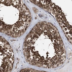 Immunohistochemical staining of human testis shows strong cytoplasmic positivity in cells in seminiferous ducts.