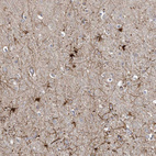 Immunohistochemical staining of human cerebral cortex shows strong cytoplasmic positivity in neuronal cells.