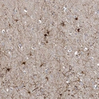 Immunohistochemical staining of human cerebral cortex shows strong cytoplasmic positivity in neuronal cells.