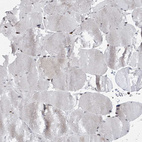 Immunohistochemical staining of human skeletal muscle shows moderate nuclear positivity in myocytes.