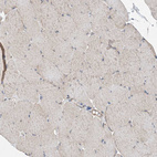 Immunohistochemical staining of human skeletal muscle shows negative to very weak cytoplasmic positivity in myocytes.