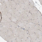 Immunohistochemical staining of human skeletal muscle shows negative to very weak cytoplasmic positivity in myocytes.
