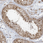 Immunohistochemical staining of human testis shows moderate granular cytoplasmic positivity in cells in seminiferous ducts.