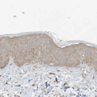 Immunohistochemical staining of human skin shows weak cytoplasmic positivity in squamous epithelial cells.