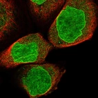 Immunofluorescent staining of human cell line A-431 shows localization to nucleus & nuclear membrane.