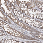 Immunohistochemical staining of human colon shows moderate granular cytoplasmic positivity in glandular cells.