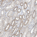 Immunohistochemical staining of human kidney shows weak to moderate cytoplasmic positivity in cells in tubules.
