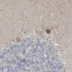 Immunohistochemical staining of human cerebellum shows weak to moderate cytoplasmic positivity in Purkinje cells.