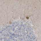 Immunohistochemical staining of human cerebellum shows weak to moderate cytoplasmic positivity in Purkinje cells.