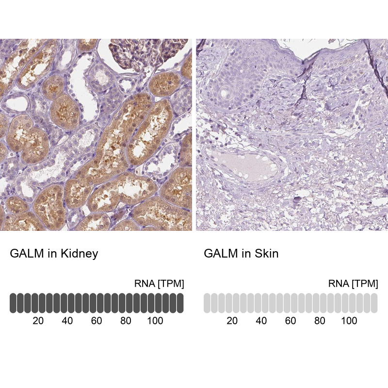 Anti-GALM Antibody