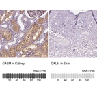 Anti-GALM Antibody