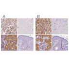 Immunohistochemical staining of human adrenal gland, cerebral cortex, kidney and skin using Anti-GALM antibody HPA035473 (A) shows similar protein distribution across tissues to independent antibody HPA035472 (B).