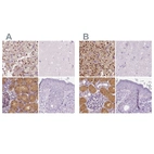 Immunohistochemical staining of human adrenal gland, cerebral cortex, kidney and skin using Anti-GALM antibody HPA035473 (A) shows similar protein distribution across tissues to independent antibody HPA035472 (B).