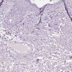 Immunohistochemical staining of human skin shows low expression as expected.