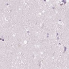 Immunohistochemical staining of human cerebral cortex using Anti-GALM antibody HPA035473.
