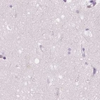 Immunohistochemical staining of human cerebral cortex using Anti-GALM antibody HPA035473.