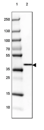 Lane 1: Marker [kDa] 250, 130, 100, 70, 55, 35, 25, 15, 10_br/_Lane 2: Human Kidney tissue