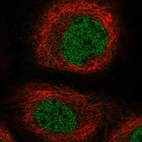 Immunofluorescent staining of human cell line A-431 shows localization to nucleoplasm.