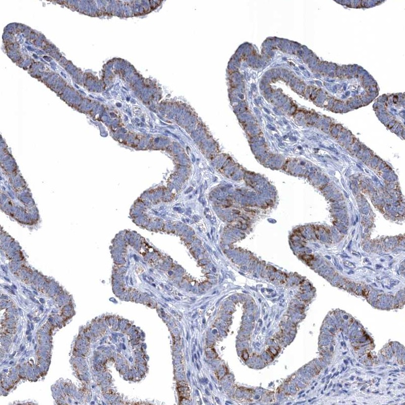Anti-TTC21B Antibody
